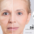 [Image: ¡Paga $75 en Lugar de $150 por 1 Sesión de Dermapen + Plasma Rico en Plaquetas para Rejuvenecimiento del Rostro, Eliminación de Estrías y Cicatrices y/o Evitar la Caída del Cabello!m]