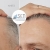 [Image: ¡Paga $75 en Lugar de $150 por 1 Sesión de Dermapen + Plasma Rico en Plaquetas para Rejuvenecimiento del Rostro, Eliminación de Estrías y Cicatrices y/o Evitar la Caída del Cabello!m]