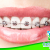 [Image: ¡Paga Q499 en lugar de Q1,800 por Colocación de Brackets Metálicos (Superiores e Inferiores) + Evaluación y Diagnóstico Clínico + Fotografías en Ortho Estetic!m]