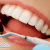[Image: ¡Paga Q85 en lugar de Q550 por Limpieza Dental Completa que Incluye: Desmanchado Dental con Profijet + Eliminación de Sarro y Placa con Ultrasonido + Aplicación Tópica de Flúor + 2 Radiografías Digitales + Examen Diagnóstico en DentalMedic!m]