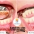 [Image: ¡Paga $9 en Lugar de $70 por Limpieza Dental con Ultrasonido + Pulido + Aplicación de Flúor + Consulta y Diagnóstico + Evaluación Clínica de Cordales!m]
