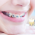 [Image: ¿Quieres una Sonrisa Perfecta? ¡Paga $90 en lugar de $550 por Colocación de Mini-Brackets Metálicos para Alinear los Dientes en Odontomerc!m]