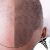 [Image: ¡Libérate de la Pérdida del Cabello! ¡Paga Q799 en lugar de Q3,600 por Tratamiento contra Alopecia (Calvicie) que Incluye: 1 Sesión de Plasma Rico en Plaquetas + 3 Sesiones de Carboxiterapia + 3 Sesiones de Luz LED!m]
