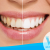[Imagen:¡Paga $59 en vez de $325 por 1 Sesión de Blanqueamiento Dental EXTREMO con sistema ZOOM + Profilaxis!]