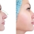 [Imagen:¡Paga Q1,899 en lugar de Q10,500 por Rinomodelación o Rejuvenecimiento Facial con Hilos Tensores + Aplicación de Ácido Hialurónico o Plasma Gel + 1 Limpieza Facial Profunda + Microdermoabrasión!]