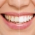 [Imagen:¡Paga Q449 en Lugar de Q3,598 por Blanqueamiento Dental con Luz LED + Limpieza Ultrasónica Profunda con Eliminación de Sarro y de Manchas de Colorantes con Pulido Profijet + Diagnóstico Integral Completo con Radiografías y Fotografías Digitales!]