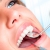[Imagen:¡Paga Q89 en Lugar de Q500 por Limpieza Dental Completa con Eliminación de Sarro + Pulido con Profijet + Aplicación Tópica de Flúor + Examen de Diagnóstico Completo y Evaluación!]