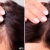 [Imagen:¡Paga $75 en Lugar de $300 por 3 Sesiones de Mesoterapia y Altafrecuencia Capilar para Estimular el Crecimiento del Cabello y Evitar La Calvicie!]