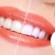 [Imagen:¡Paga Q395 en Vez de Q1,500 por Blanqueamiento con Luz LED + Limpieza y Pulido Dental con Profilaxis + Eliminación de Sarro con Ultrasonido + Aplicación Tópica de Flúor + Examen Diagnóstico!]