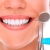 [Imagen:¡Paga Q89 en Lugar de Q600 por Limpieza Dental Completa con Eliminación de Sarro y Placa con Ultrasonido + Pulido con Profijet + Aplicación Tópica de Flúor + Examen de Diagnóstico Completo y Evaluación!]