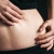 [Imagen:¡Paga Q299 en Lugar de Q2,000 por 4 Sesiones para Desvanecer Estrías en Área a Elección entre Glúteos, Abdomen, Entrepierna, Laterales, Antebrazo o Aleta con: Láser + Microdermoabración + Carboxiterapia + Radiofrecuencia + Exfoliación y Más!]