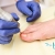 [Imagen:¡Paga $18 en Lugar de $90 por 2 Sesiones de Láser para 3 Uñas con Hongos + Evaluación Médica!]