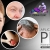 [Imagen:¡Paga $175 en Lugar de $350 por 3 Sesiones de Plasma Rico en Plaquetas para Rejuvenecimiento Facial, Calvicie o Dolor en Articulaciones + 3 Limpiezas Faciales con 3 Microdermoabrasiones + 3 Extracciones de Puntos Negros + Consulta Médica!]
