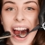[Imagen:¡Paga Q89 en Lugar de Q600 por Limpieza Dental Completa con Eliminación de Sarro y Placa con Ultrasonido + Pulido con Profijet + Aplicación Tópica de Flúor + Examen de Diagnóstico Completo y Evaluación!]
