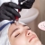 [Imagen:¡Paga Q199 en Lugar de Q1,500 por Sesión de Dermapen con Cóctel de Ácido Hialurónico, Argireline y Vitaminas E y C!]