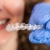 [Imagen:¡Paga $18 en Lugar de $125 por Férula Dental + Limpieza Dental con Sistema de Succión con Aerosol + Aplicación Tópica de Flúor + Evaluación!]