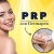 [Imagen:¡Paga $30 en Lugar de $90 por Aplicación de Plasma Rico En Plaquetas con Dermapen + Limpieza de Rostro + Exfoliación + Mascarilla de Vampiro + Mascarilla Hidratante + Reparador Dérmico!]