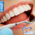 [Imagen:¡Paga Q85 en lugar de Q550 por Limpieza Dental Completa que incluye: Desmanchado Dental con Profijet + Eliminación de Sarro y Placa con Ultrasonido + Aplicación Tópica de Flúor + 2 Radiografías Digitales + Examen Diagnóstico en DentalMedic!]