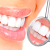 [Imagen:¡Paga Q259 en lugar de Q1,450 por Paquete Dental con: 2 Rellenos o 4 Sellantes + Limpieza con Ultrasonido + Pulido Dental con Profijet + Aplicación de Fluor + 2 Radiografías + Exámen Diagnóstico con Cámara Intraoral en Estética Dental Oakland!]