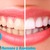 [Imagen:¡Paga $70 en lugar de $237 por Blanqueamiento Dental con Sistema Zoom + Limpieza con Ultrasonido + Diagnóstico con Cámara Intraoral + Revisión de Cordales en Clínica Médica Romano y Asociados!]