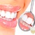 [Imagen:¡Paga $19 en vez de $145 por 2 Rellenos de Resina o 4 Sellantes + Limpieza Dental con Ultrasonido + Pulido Dental + Aplicación de Flúor + Consulta Odontológica y Diagnóstico Bucodental en Odontomerc!]