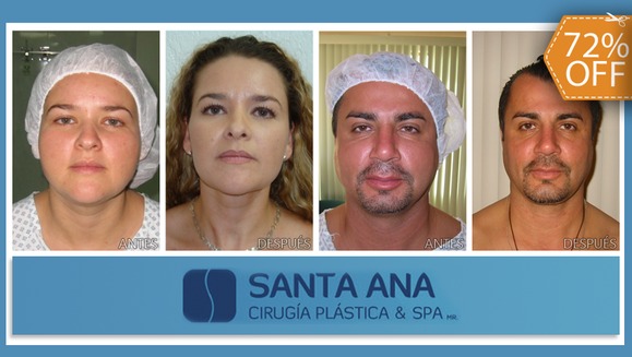[Image: ¡Paga $425 en Lugar de $1,500 por Bichectomía: Cirugía de Adelgazamiento Facial!m]