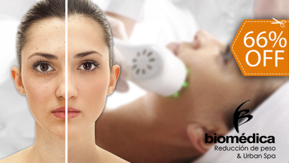 [Image: ¡Paga $17 en Lugar de $50 por 1 Sesión de Fototerapia Láser Antiacné, Antiarrugas y Antimanchas + 1 Exfoliación Facial con Café + 1 Hidratación Profunda + 1 Limpieza Profunda con Peeling Orgánico!m]