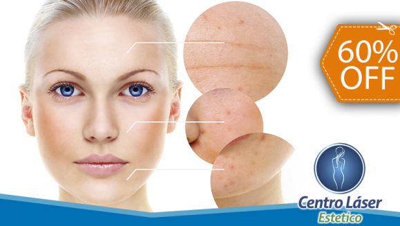 [Image: ¡Paga $40 en Lugar de $100 por 3 Sesiones Faciales Antiacné, Antimanchas o Antiaging con: 1 Sesión de Láser IPL + 2 Fototerapias con Luz Led + 3 Limpiezas Faciales + 3 Exfoliaciones + 3 Mascarillas!m]