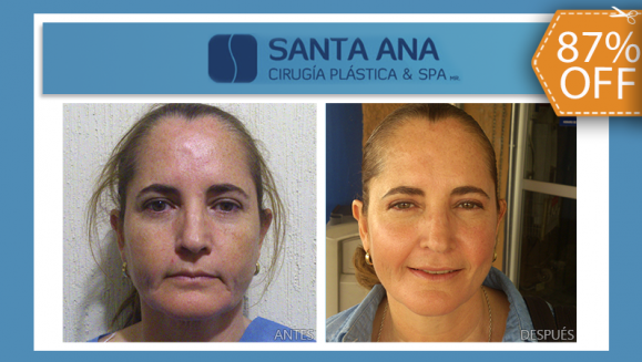 [Image: ¡Paga $175 en lugar de $1,350 por 3 Sesiones de Plasma Rico en Plaquetas para Rejuvenecimiento Facial!m]