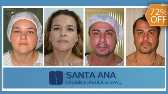 [Image: ¡Paga $425 en lugar de $1,500 por Bichectomía: Cirugía de Adelgazamiento Facial!m]