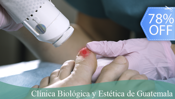 [Image: ¡Paga Q249 en lugar de Q1,150 por Sesión Láser para Tratar los Hongos en las 10 Uñas de las Manos o Pies + Pedicure o Manicure Clínico (Limpieza de Canales, Exfoliación, Recorte y Limado de Uñas, Gel Antiinflamatorio y Más) + Evaluación Médica!m]