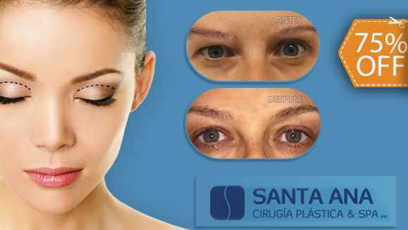 [Image: ¡Paga $550 en Lugar de $2,200 por Blefaroplastia Superior: Técnica Quirúrgica para Eliminar los Párpados Caídos y Rejuvenecer la Mirada!m]