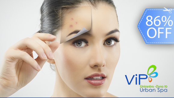 [Image: ¡Paga Q149 en vez de Q1,042 por Facial Antiacné con: 2 Microdermoabrasiones + 2 Peelings Ultrasónicos + 2 Terapias LED + 2 Alta frecuencia + Limpieza Facial con Brossage, Exfoliación Micronizada, Vaporización, Extracciones de Puntos Negros y Más!m]