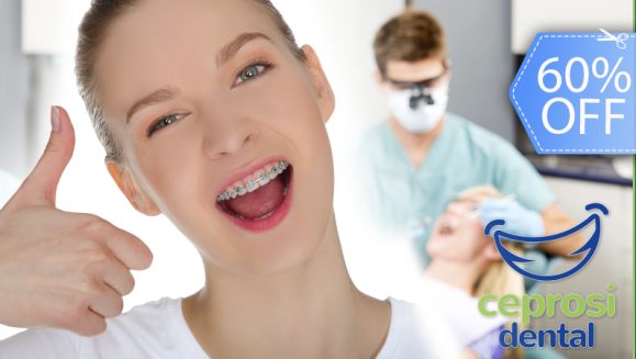 [Image: ¡Paga Q599 en lugar de Q1,500 por Colocación de Mini-Brackets Metálicos (Inferior y Superior) + Set de Radiografías Intraorales + Modelos de Estudio + Limpieza Dental + Kit de Limpieza con Cepillos Enjuague y Más!m]