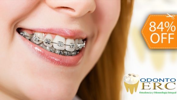 [Image: ¡Logra la Sonrisa que Siempre Soñaste! ¡Paga $90 en lugar de $550 por Colocación de Mini-Brackets Metálicos para Alineación de los Dientes + Evaluación y Diagnóstico Clínico + Fotografías y Modelo de Estudio!m]