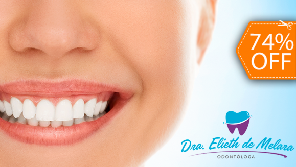 [Image: ¡Paga $69 en Lugar de $265 por Blanqueamiento Dental con Lámpara UV + Limpieza con Ultrasonido + Aplicación de Gel Desensibilizante!m]