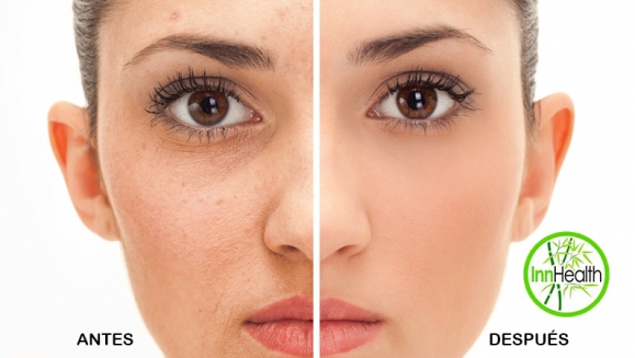 [Image: ¡Paga $16 en Lugar de $75 por Microdermoabrasión con Punta de Diamante + Limpieza Facial + Exfoliación + Vaporización + Extracción de Puntos Negros + Mascarilla de Yogurt y Frutos Rojos Marca Anubis + Aromaterapia!m]