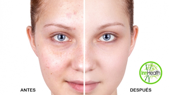 [Image: ¡Paga $16 en Lugar de $75 por Microdermoabrasión con Punta de Diamante + Limpieza Facial + Exfoliación + Vaporización + Extracción de Puntos Negros + Mascarilla de Yogurt y Frutos Rojos Marca Anubis + Aromaterapia!m]
