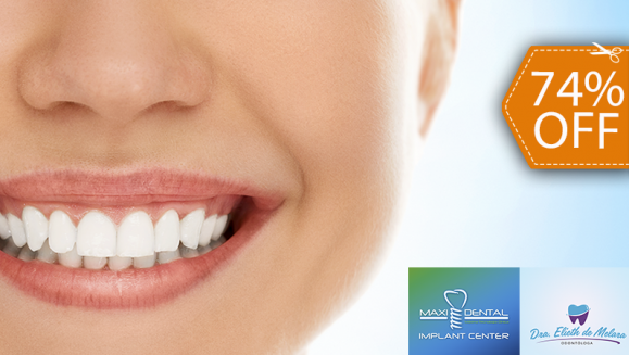 [Image: ¡Paga $69 en Lugar de $265 por Blanqueamiento Dental con Lámpara UV + Limpieza con Ultrasonido + Aplicación de Gel Desensibilizante!m]