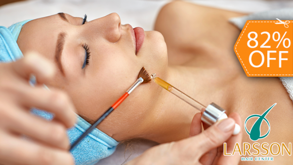 [Image: ¡Paga $20 en Lugar de $110 por 2 Sesiones Faciales con: 1 Peeling Mándelico o Glicopeel + 1 Mascarilla Antioxidante de Vitamina C o Antiacné + 2 Limpiezas Profundas + 1 Extracción de Puntos Negros + 2 Altafrecuencias + 2 Exfoliaciones y Más!m]