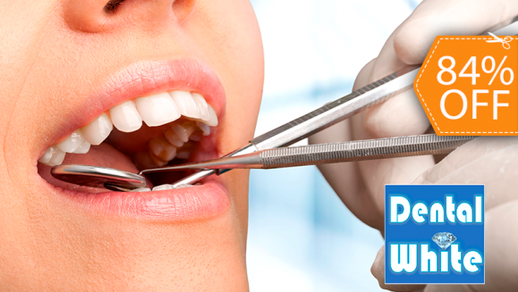 [Image: ¡Paga $20 en Lugar de $125 por 2 Rellenos Dentales o 3 Sellantes + Limpieza con Ultrasonido + Aplicación de Flúor + Evaluación de Cordales + Consulta y Diagnostico!m]