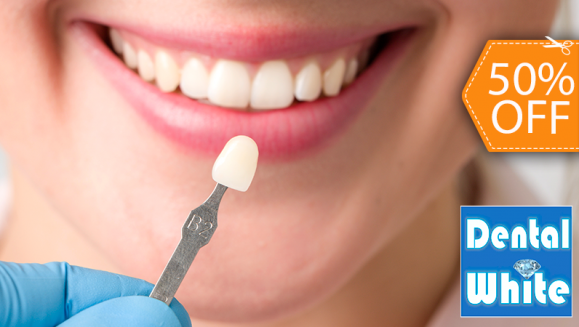 [Image: ¡Logra una Sonrisa Perfecta! ¡Paga $75 en Lugar de $150 por Carilla Dental de Resina Compuesta!m]