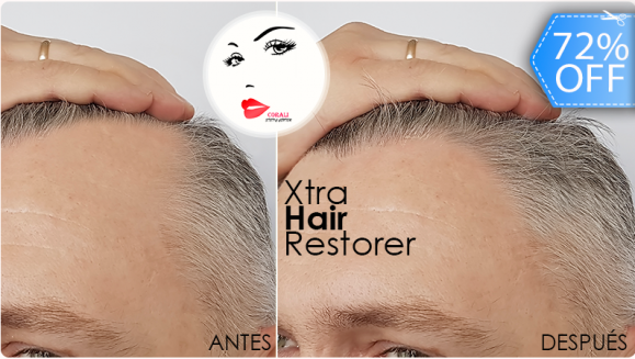 [Image: ¡Paga Q199 en lugar de Q700 por Tratamiento Anticalvicie que Incluye: 2 Sesiones de Mesoterapia Xtra Hair Restorer + 2 Altafrecuencia + 2 Luces de Fotón + 2 Estimuladores de Ozono!m]