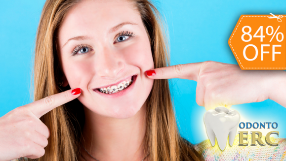 [Image: ¡Logra Una Sonrisa Perfecta! ¡Paga $90 en Lugar de $550 por Colocación de Mini-Brackets Metálicos!m]