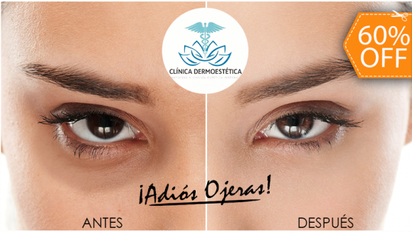 [Image: ¡Paga $10 en Lugar de $25 por 1 Sesión de Tratamiento Antiojeras que Incluye: Microdermoabrasión + Peeling + Consulta Médica!m]