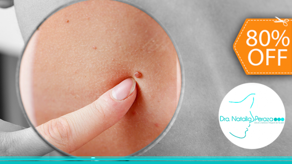 [Image: ¡Paga $20 en Lugar de $100 por Eliminación de hasta 20 Verrugas o Cabezas de Vena en Cuello, Axilas o Rostro + Consulta Dermatológica!m]