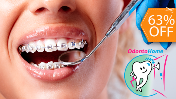[Image: ¡Paga $75 en Lugar de $200 por Colocación de Brackets Metálicos + Evaluación y Diagnóstico Clínico + Fotografías y Modelo de Estudio!m]
