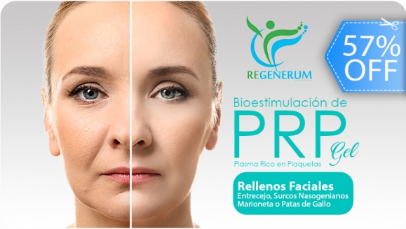[Image: ¡Paga Q325 en lugar de Q750 por Rejuvenecimiento Facial con Relleno de Plasma Gel (Bioestimulación de PRP) en Área a Elección entre Entrecejo, Surcos Nasogenianos, Marioneta o Patas de Gallo!m]