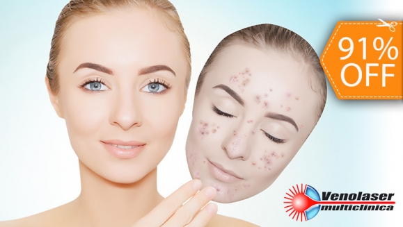 [Image: ¡Paga $90 en lugar de $950 por 4 Sesiones Faciales de Láser Antiacné + 4 Limpiezas!m]