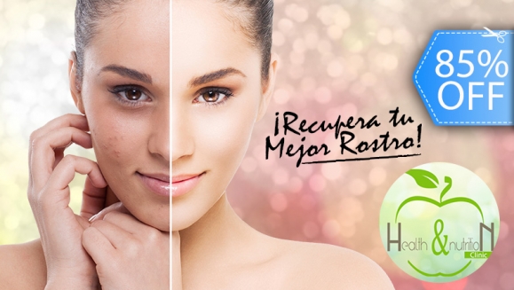 [Image: ¡Paga Q139 en lugar de Q900 y Reduce Acné, Manchas o Arrugas con: 1 Pre-Peeling de Bambú y Ácido Glicólico + 1 Peeling Ultrasónico + 1 Vaporización con Ozono + 1 Extracción de Impurezas + 1 Mascarilla de Colágeno Puro Hidrolizado y Más!m]